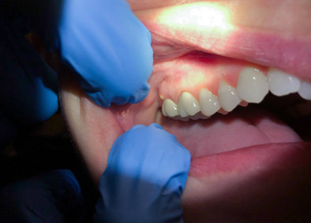 Emergency Dental Care for Seniors